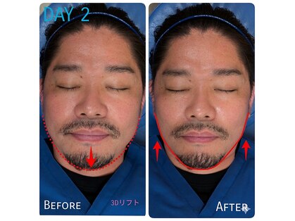 浦和のあ鍼灸整骨院の写真