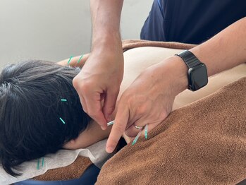 リケア 西新宿鍼灸院(reCare)の写真/新宿NEW【肩こり/腰痛/頭痛】学位者のみ在籍、ベテラン鍼灸師◎適切な刺激量でオーダーメイド鍼灸を!