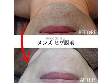 ブルージュ(Brugge)の雰囲気（丁寧な施術と、高い効果を誇る脱毛が高評価★結果が出せる脱毛。）