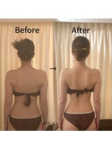 ビュール 銀座(BeauL)/ブライダルエステ♪