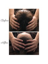 ウルエッテ(UluEtte)/特許庁認定[循環小顔]福岡小顔