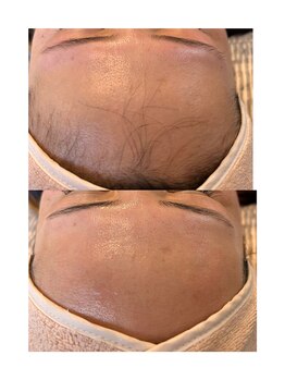 エーワキシング(A.Waxing)/