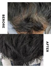 ターミナルジム アンド ビューティーサロン(TERMINAL GYM&BEAUTY SALON)/頭皮ペイント＋プラズマシャワー