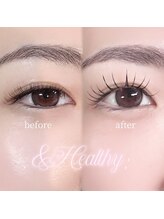 リンベル 天白店(LINBELLE)/BINDLOCK60+アンドヘルシー