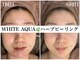 ホワイトアクア 加古川店(WHITE AQUA)の写真