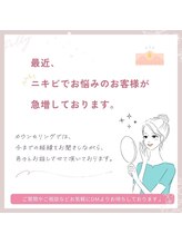 ポリー(Polly)/繰返すニキビ　改善へ