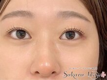 サクラブロウ 心斎橋店(Sakura-blow)/まつげパーマパリジェンヌ眉毛