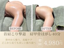 スカイ(sky)の雰囲気（【ブライダル】巻き肩改善で360度美しいラインへ）