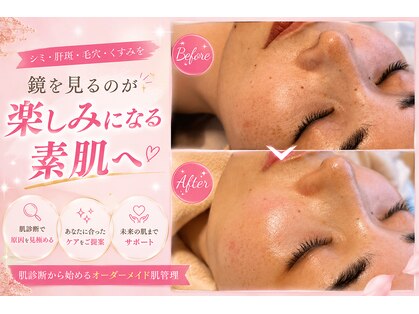 ミラビューティー(Mira Beauty)の写真