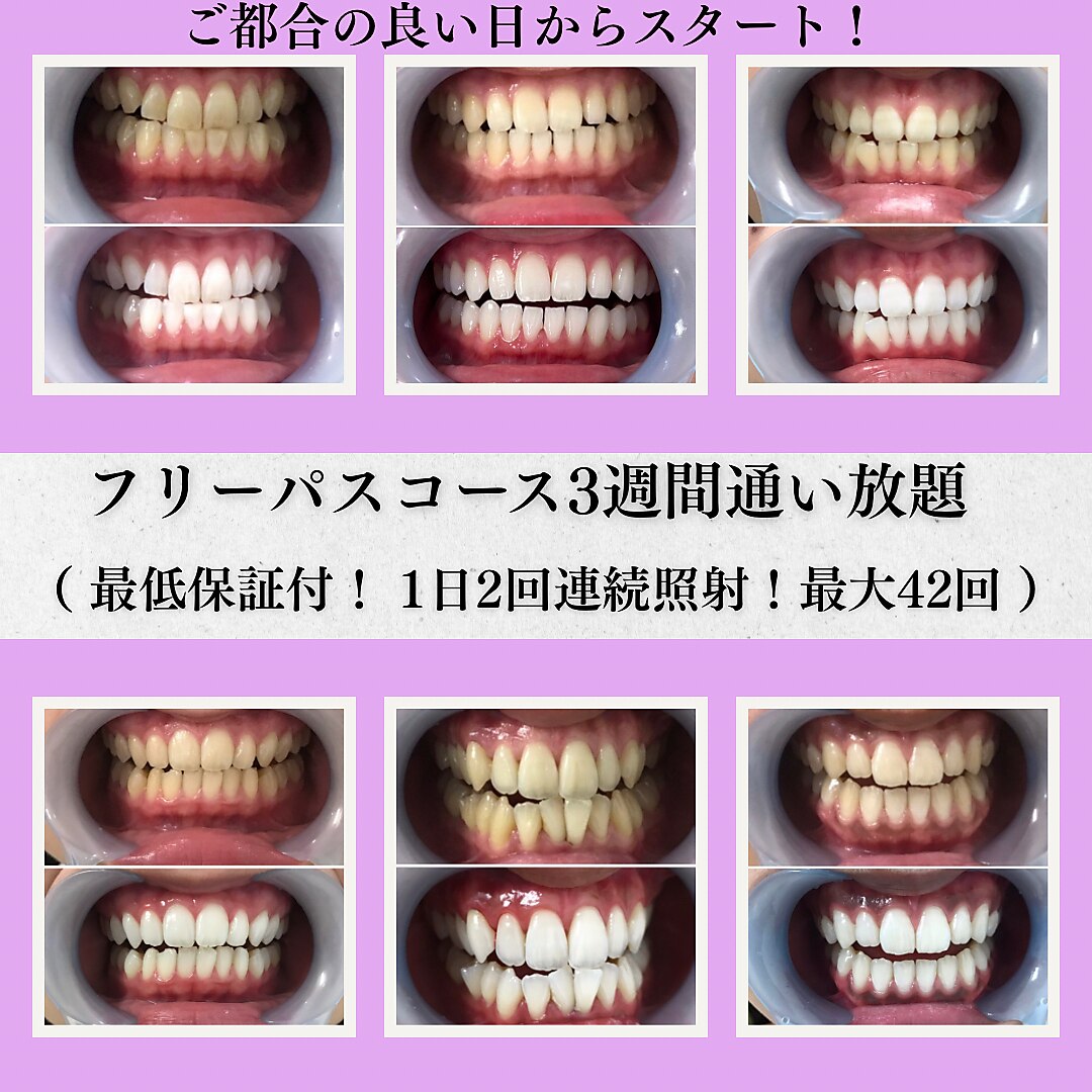 ルブラン 奈良店(Le Blanc)｜ホットペッパービューティー