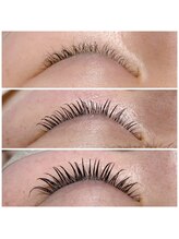 バンビちゃんのお目目 熊本店/3ヶ月で！！！変わる！