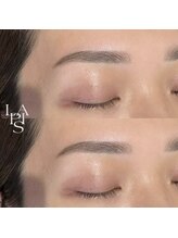 フレイズラピス(FRASE Lapis)/ハリウッドブロウリフト