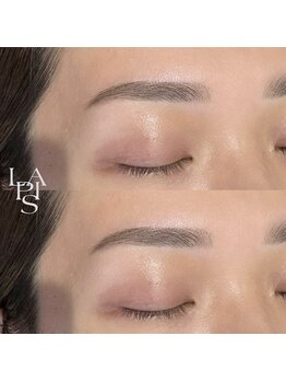 フレイズラピス(FRASE Lapis)/ハリウッドブロウリフト