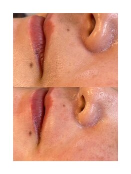 エーワキシング(A.Waxing)/