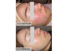 セルヴィ(Cellvi)の雰囲気（結果重視のフェイシャルが人気◎）