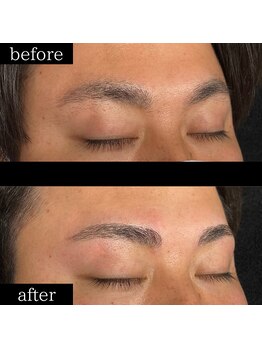 ユー 千葉駅前店(you)/症例写真