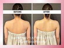 リス ブラン ビューティー(Lys blanc beauty)/６０分コルギBefore×After