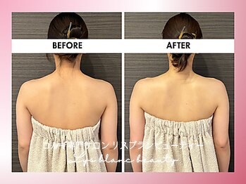 リス ブラン ビューティー(Lys blanc beauty)/60分コルギBefore×After