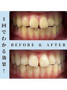 ドルチェ 水戸店(Dolce)/★ before → after ★