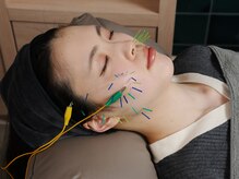 ミエリア美容鍼灸院(mielia美容鍼灸院)