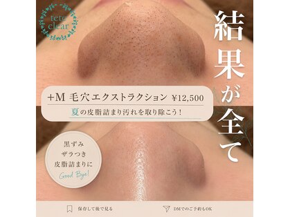 プラスエム(+M)の写真