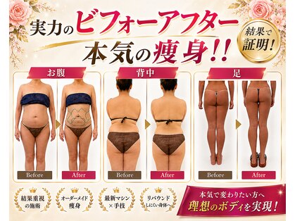 スリムグラシアナ 大橋駅前店(SlimSpa Graciana)の写真