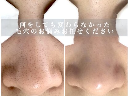 ミラボ(melab)の写真