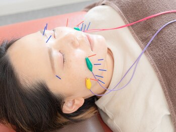 けいのき鍼灸整骨院/美容鍼/ニキビケア/鍼/小顔/毛穴