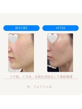 ミーティア(Meteor)/