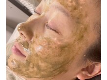 アップル マリー 江別/■ハーブピーリング