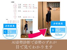 AI診断で姿勢不良が目で見てわかる！肩こり・頭痛も姿勢から改善