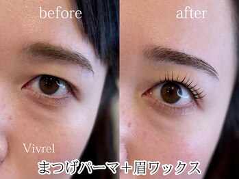 ヴィヴレル(Vivrel)