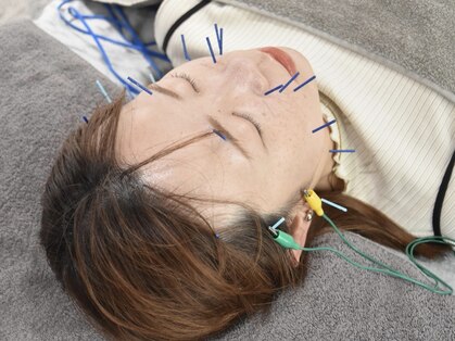 アキュリラ(Acurela)の写真