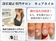 キュアネイル(Qa Nail)