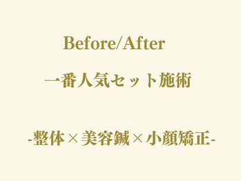 チャンス 西院(chance)/整体×美容鍼×小顔矯正