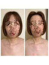 ヨサパーク リアン(YOSA PARK Lien)/モニター様before→after/痩身