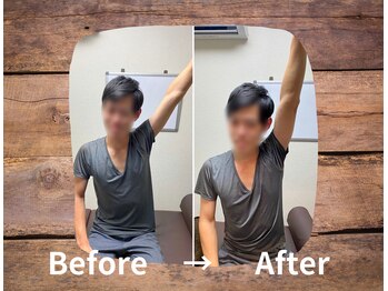 整体院プリュ/Before→ After［9］