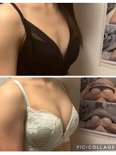 キレイバスト(Kireiii Bust)/ビフォーアフター