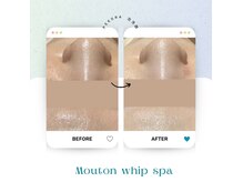 泡を使ったエステで毛穴洗浄・エイジングケア・癒し効果