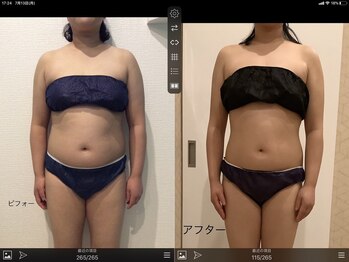 セレー(SELENE)/◇6ヶ月コース◇60分24コース