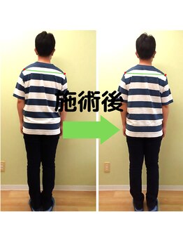 てっく整体院/30代男性姿勢比較写真