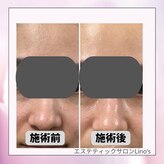 リノズ(Lino's)