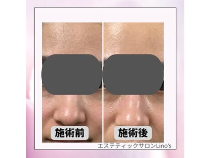 リノズ(Lino's)の写真