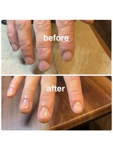 メンズネイルビズ 赤坂(Men's Nail Biz)/COATING｜印象補正コーティング