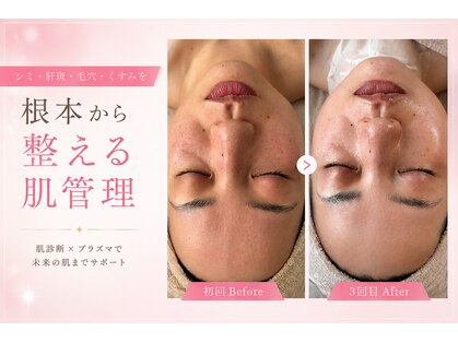 ミラビューティー(Mira Beauty)の写真