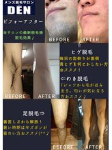 デン(DEN)/ビフォーアフター