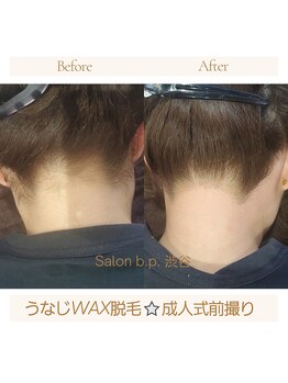 ビーピー 渋谷(b.p.)/うなじWAX脱毛 うなじ脱毛