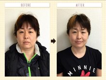 ウェリナ平和堂長久手院/小顔矯正/骨盤矯正/痩身/整体