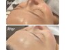 【肌質改善×陶器のようなキメ肌】韓国艶玉フェイシャル¥13000→¥10000