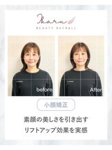 イカル 池袋(ikaru)/小顔矯正 before after 
